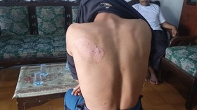 Nestapa Santri Disabilitas di Gresik Diduga Disetrika Junior