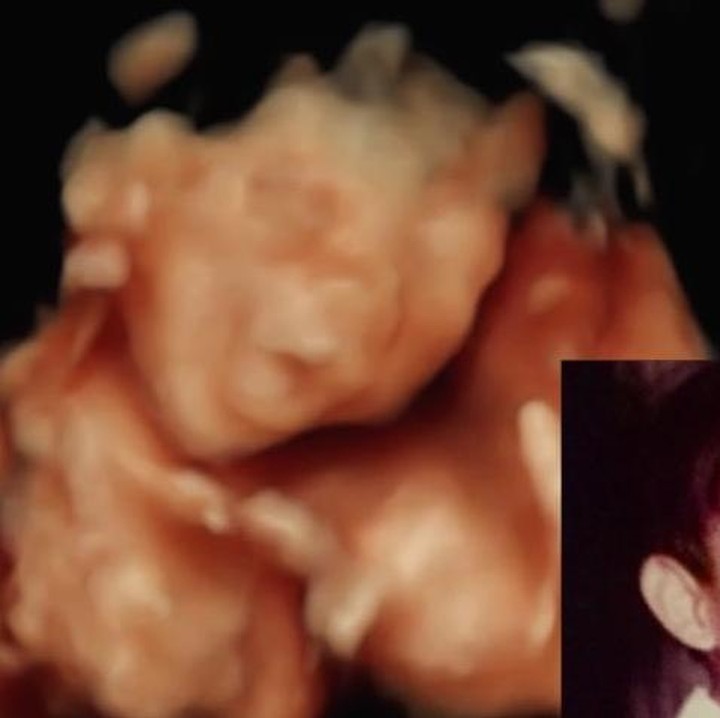 <p>Perjalanan kehamilan pertama Anizabella dibagikan oleh Ryan Andriandhy lewat akun Instagramnya. Ryan membagikan tepat di momen lebaran idul fitri 2026. Pria 36 tahun ini menunjukkan foto USG calon anak pertamanya. Ia menyebut senyum Si Kecil mirip dirinya sedangkan momen serius mirip sang istri. "Dari dalam rahim kok mangap ketawanya persis Ayah..MIKIRNYA persis Mommy," tulis Ryan. (Foto: @adriandhy).</p>
