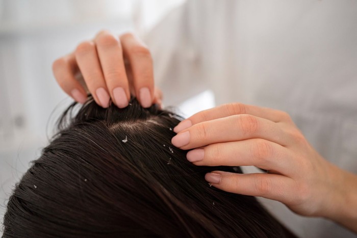 Manfaat minyak serai untuk rambut adalah membantu melawan ketombe dan kulit kepala yang gatal.