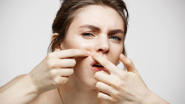 5 Kesalahan Pakai Pimple Patch yang Bikin Jerawat Tak Kunjung Kempes