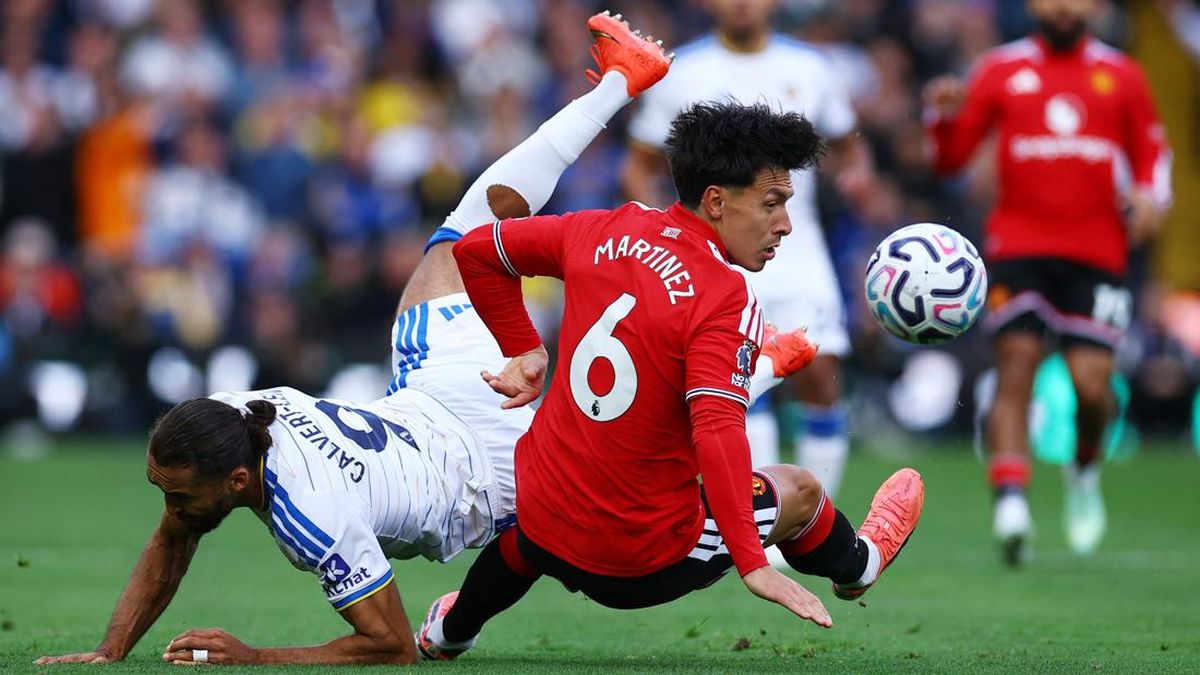 MU Gagal Menang Lagi, Lisandro Martinez Cedera — NadiKabar.com