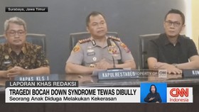 Tragedi Bocah Down Syndrome Tewas dibully