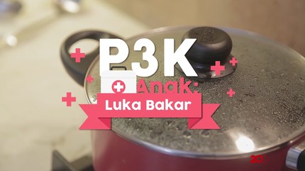 Tahun Baru? Waspadai Luka Bakar pada Anak
