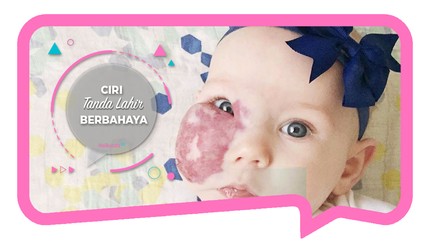 Ciri Tanda Lahir yang Berbahaya 