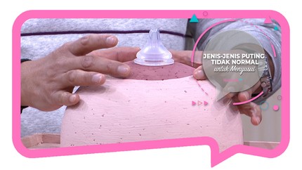 Jenis-jenis Puting Tidak Normal untuk Menyusui